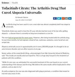 Screenshot of a news article discussing tofacitinib citrate as a potential treatment for alopecia universalis.