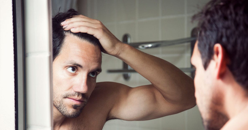 man looking at his hairline before his hair transplant in Miami, FL