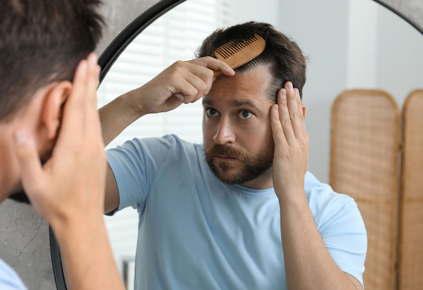 man brushing his hair in the mirror before his hair transplant in Miami, FL