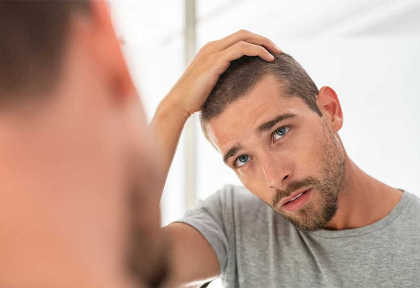 FUE Recovery Time: What To Expect, How To Plan, and How To Heal Well