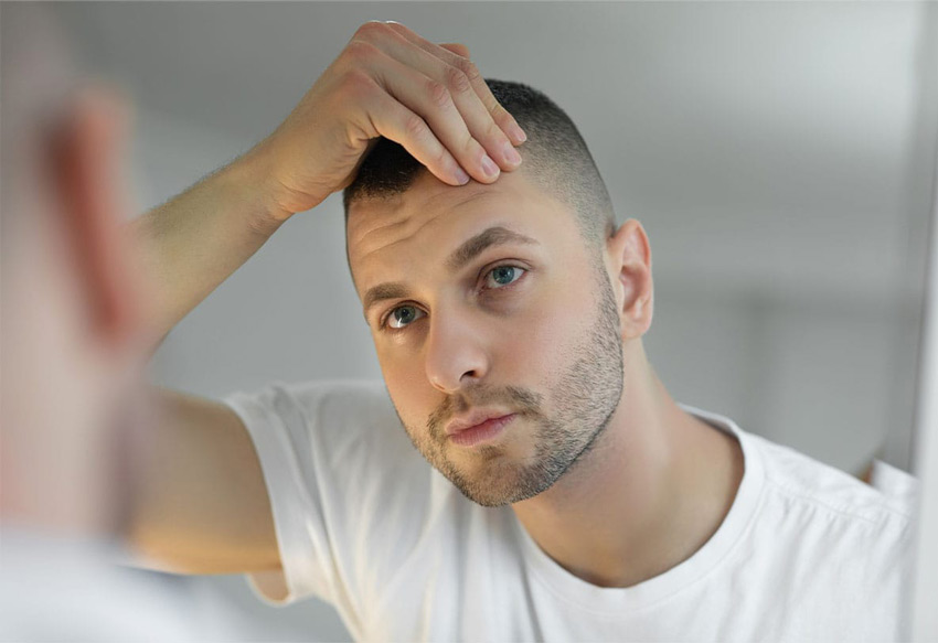 Hair Transplant Recovery Timeline Guide: What to Expect Week by Week