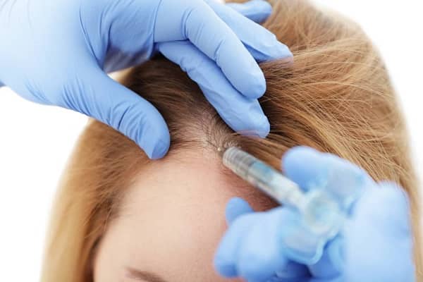 Clinician performing a hair transplant procedure on a patient's hairline.