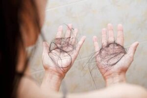 Person holding clumps of shed hair in both hands, illustrating excessive hair loss.